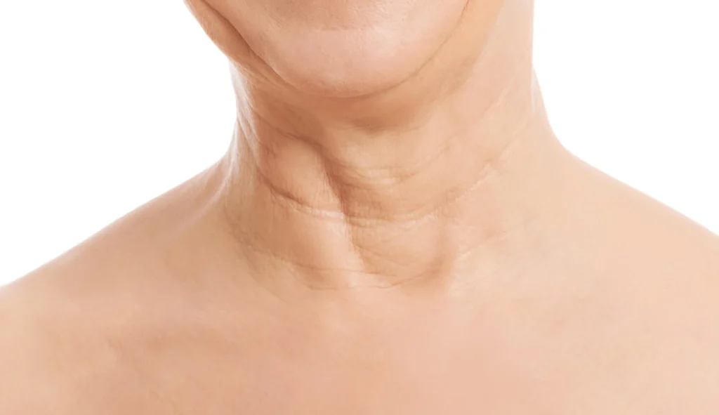 Understanding skin aging signs and causes (2)