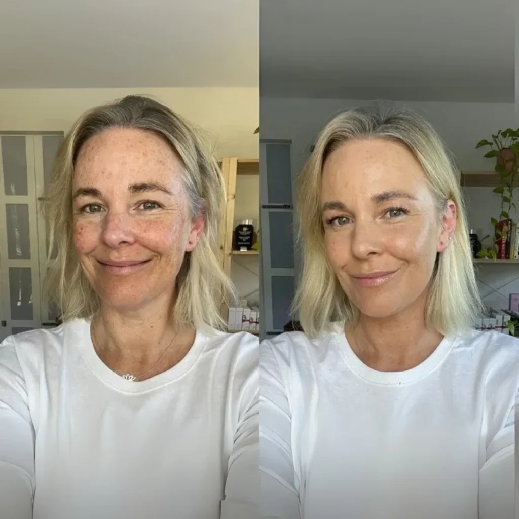 Quelles sont les teintes disponibles et la promesse de l’effet SkinMatch