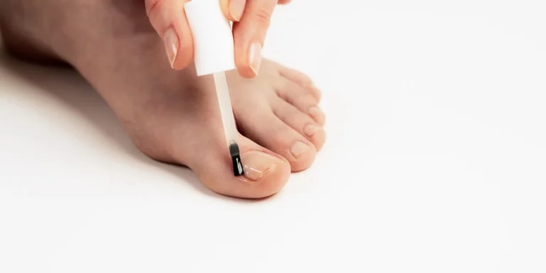 Poderm Ongles Fragilisés avis complet et efficacité réelle