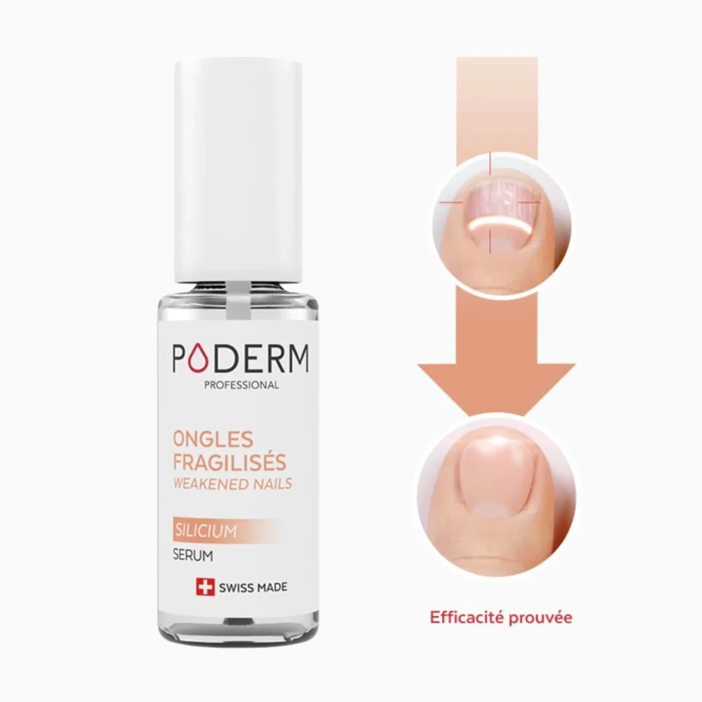 Qu’est ce que le sérum Poderm Ongles Fragilisés et à quoi sert il