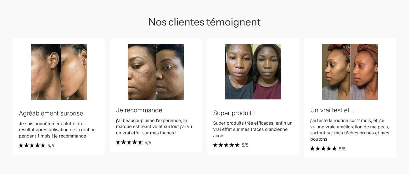 Curculia avis, ce que les clients disent vraiment de la marque